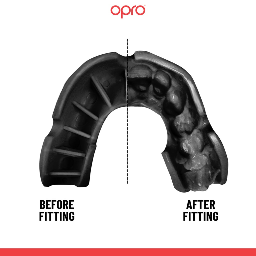 OPRO Bronze Self-Fit Mouthguard